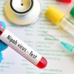 Kemenkes Pastikan Nihil Kasus Virus Nipah di RI, Waspada Tetap Jadi Kunci