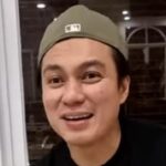 Baim Wong Jawab Isu Operasi Hidung di Korea, Sebut Cuma Jalani Treatment Stem Cell